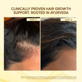 Moonlight Growth™ Scalp Serum